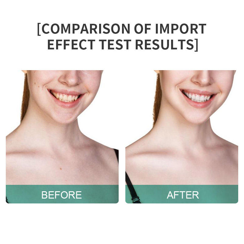 Microcurrent Face Lift Wand
